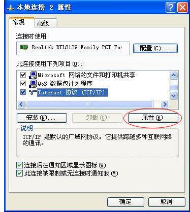 本地连接